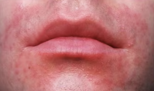 Screenshot 2025-04-07 at 10.24.03 PM.png Screenshot 2025-04-07 at 10.24.03 PM.png