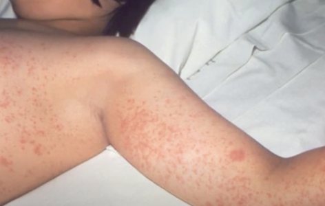 Screenshot 2025-04-24 at 8.27.47 PM.png Screenshot 2025-04-24 at 8.27.47 PM.png