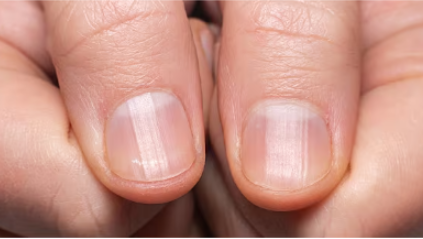 Capture.PNG Capture.PNG