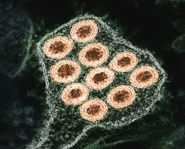 rabies.png rabies.png