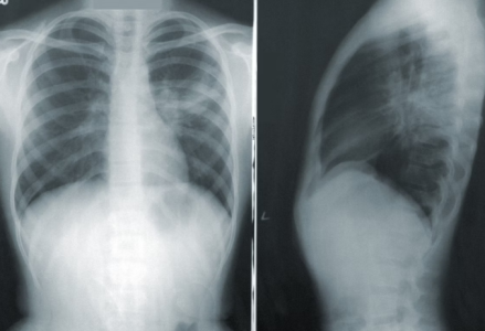 Capture.PNG Capture.PNG