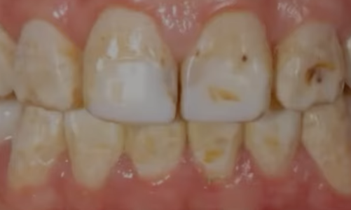 Screenshot 2025-08-19 at 10.33.54 PM.png Screenshot 2025-08-19 at 10.33.54 PM.png