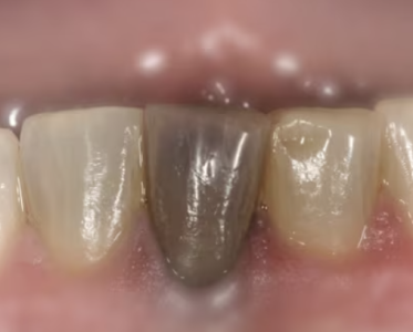 Screenshot 2025-08-19 at 10.39.31 PM.png Screenshot 2025-08-19 at 10.39.31 PM.png